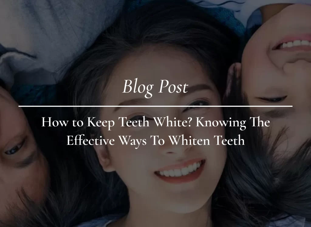 how-to-keep-teeth-white-knowing-the-effective-ways-to-whiten-teeth-1024x748.webp