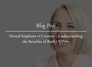 dental implants vs crowns baulkham hills