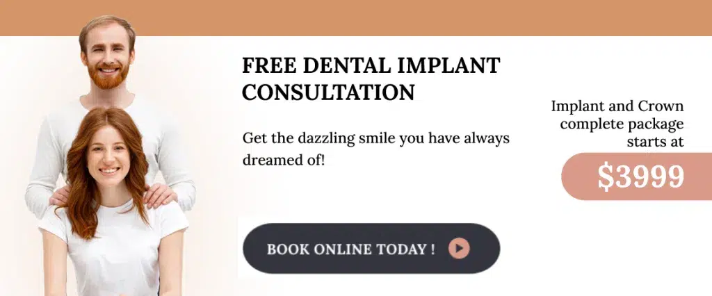 free dental implant